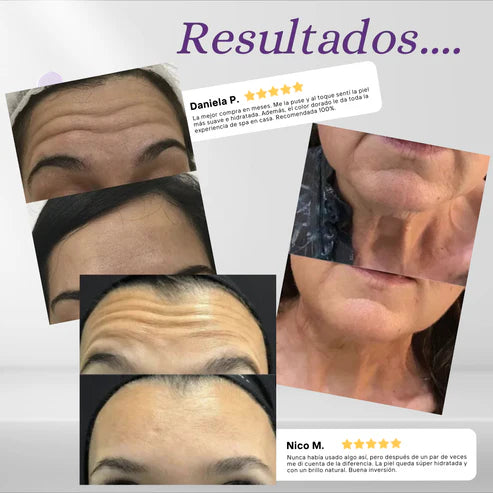 ✨GoldenGlow, Rostro más firme, hidratado y rejuvenecido ✨